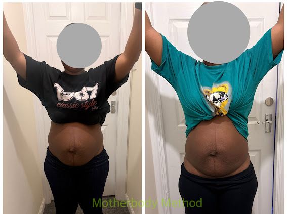Before and after front view – belly noticeably reduced