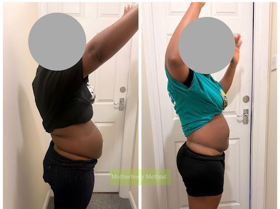 Before and after side view – belly overhang significantly reduced