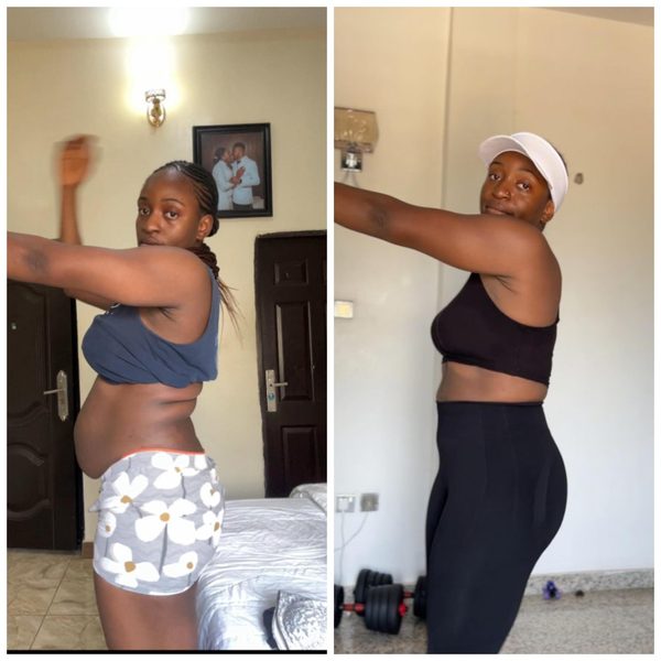 Prudiee's own C-section postpartum journey – before and after